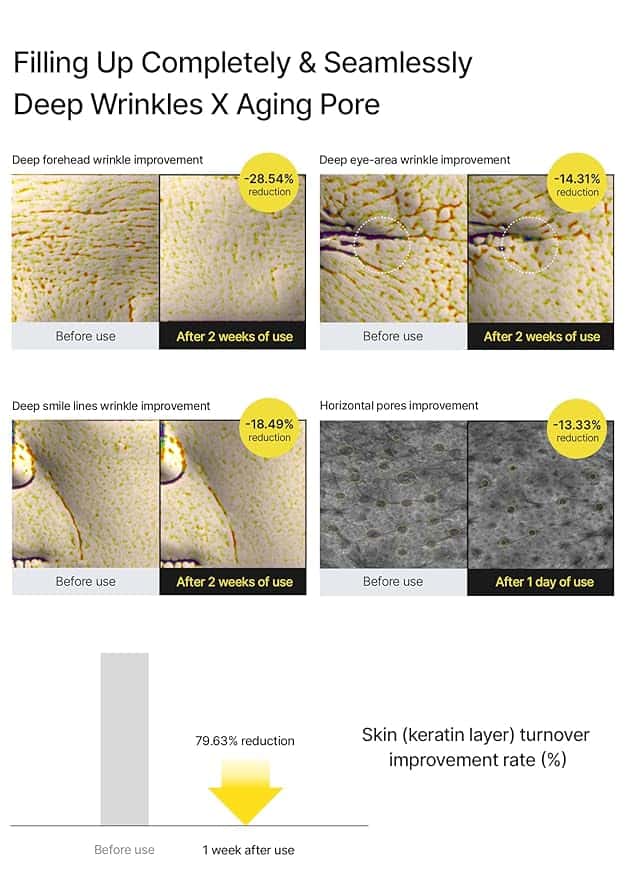 celimax The Vita A Retinal Shot Tightening Booster | with Retinal 0.1%, Matryxyl 3%, Pore Minimizer, Wrinkles & Fine Lines, Firmer Skin, 15ml