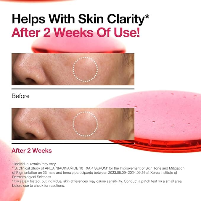 ANUA Niacinamide 10 + TXA 4 Serum, Hyaluronic Acid, Tranexamic acid, Facial Serum for Glass Skin, Clarifying, Radiant Complexion with Natural Color, Korean Skin Care (30ml /1.01 fl.oz) - Beauty & Cosmetics - Serum - $22.00