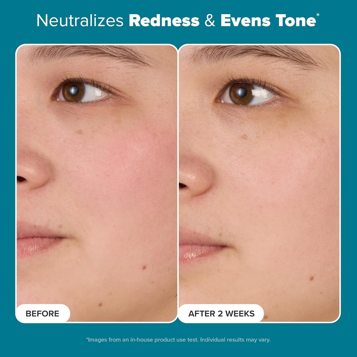 Paula's Choice SKIN BALANCING Pore-Reducing Face Toner with Niacinamide