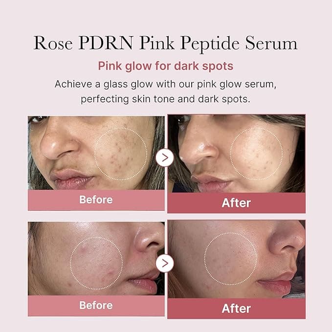 medicube PDRN Pink Peptide Serum, Pink glow serum, Peptide, Niacinamide, Hydrating & Moisturizing & Firming, Uneven Skin Tone, Korean Skincare | 1.01 fl.oz. (1.01 fl.oz., Rose PDRN (Vegan)) - Beauty & Cosmetics - Serum - $18.90