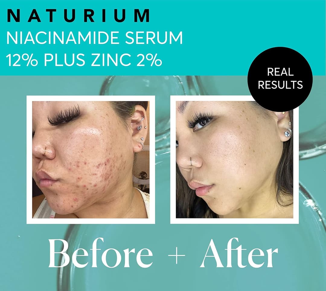 Naturium Niacinamide Face Serum 12% Plus Zinc 2%